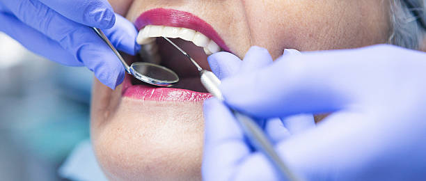 Best Cracked Tooth Emergency Dentist  in Union, OH